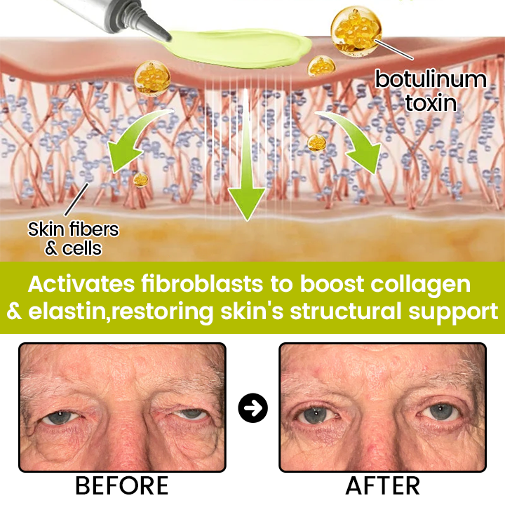[🔥Last Day 80% OFF] Timilk® Botox & Retinol Shot – Smoother-Looking Skin for Deep Lines, Sagging Jowls & Puffy Eyes
