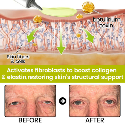[🔥Last Day 80% OFF] Timilk® Botox & Retinol Shot – Smoother-Looking Skin for Deep Lines, Sagging Jowls & Puffy Eyes