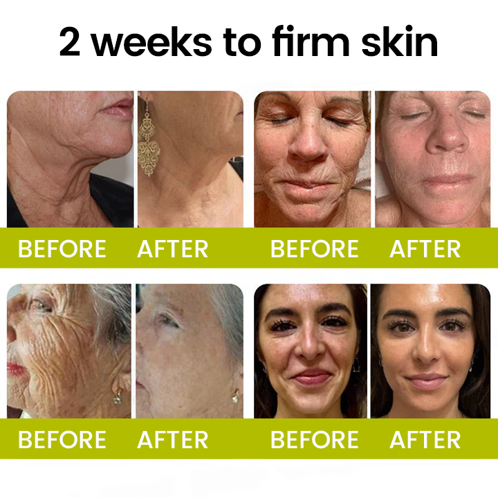 [🔥Last Day 80% OFF] Timilk® Botox & Retinol Shot – Smoother-Looking Skin for Deep Lines, Sagging Jowls & Puffy Eyes