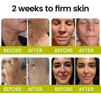[🔥Last Day 80% OFF] Timilk® Botox & Retinol Shot – Smoother-Looking Skin for Deep Lines, Sagging Jowls & Puffy Eyes