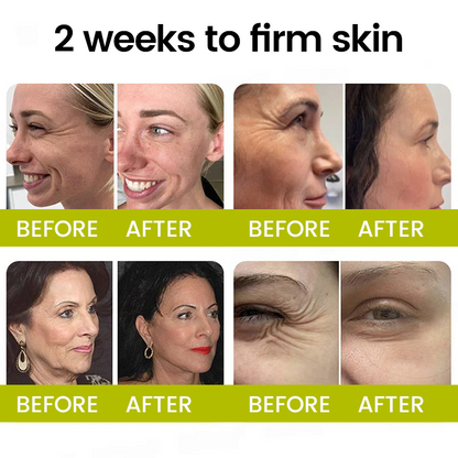 [🔥Last Day 80% OFF] Timilk® Botox & Retinol Shot – Smoother-Looking Skin for Deep Lines, Sagging Jowls & Puffy Eyes