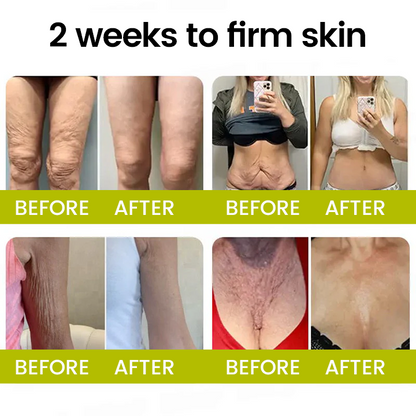 [🔥Last Day 80% OFF] Timilk® Botox & Retinol Shot – Smoother-Looking Skin for Deep Lines, Sagging Jowls & Puffy Eyes